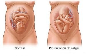 posición del feto